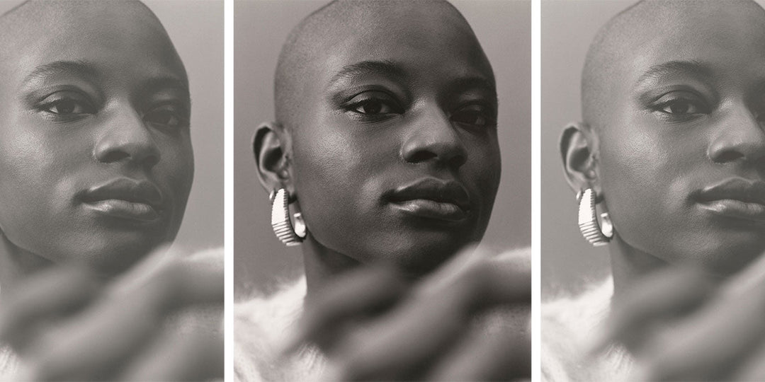 L'alopécie un sujet encore tabou chez les femmes noires ?
